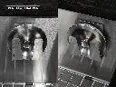 Porta esponja e valvula.webp